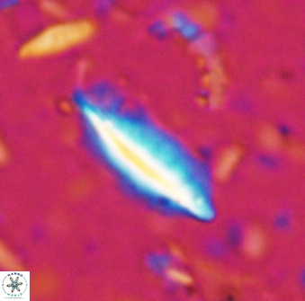 Triquetrorhabdulus milowii 28142