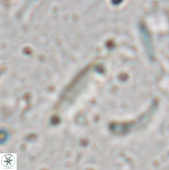 Triquetrorhabdulus milowii 28148