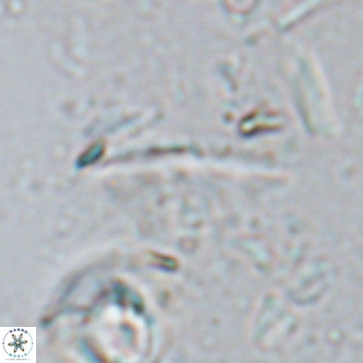 Triquetrorhabdulus milowii VR 16755