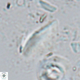 Triquetrorhabdulus milowii VR 16756