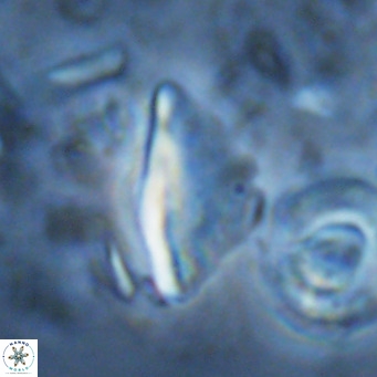 Triquetrorhabdulus milowii VR 16763