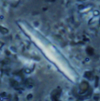 Triquetrorhabdulus rioi 22742
