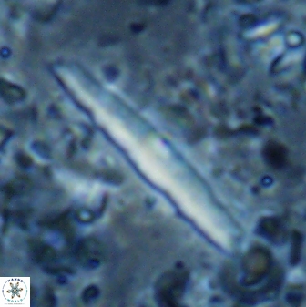 Triquetrorhabdulus rioi 22742