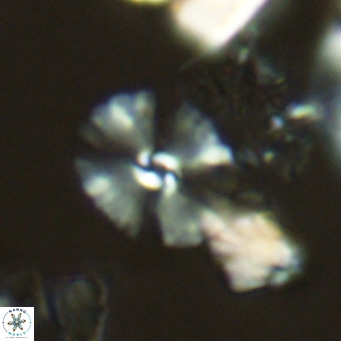 Umbellosphaera tenuis VR 04587