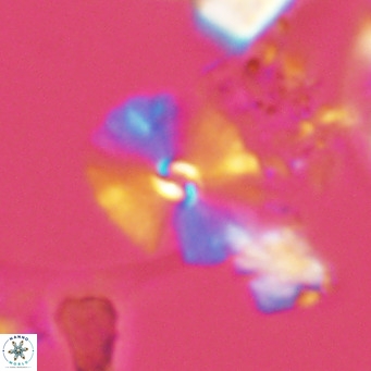 Umbellosphaera tenuis VR 04588