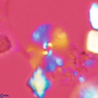 Umbellosphaera tenuis VR 04589