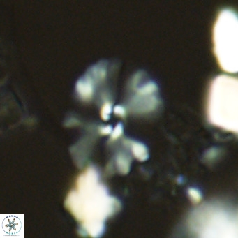 Umbellosphaera tenuis VR 04590
