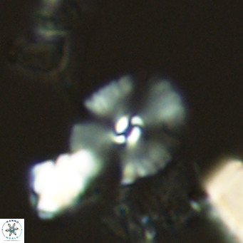 Umbellosphaera tenuis VR 04591