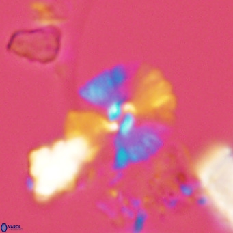 Umbellosphaera tenuis VR 04593