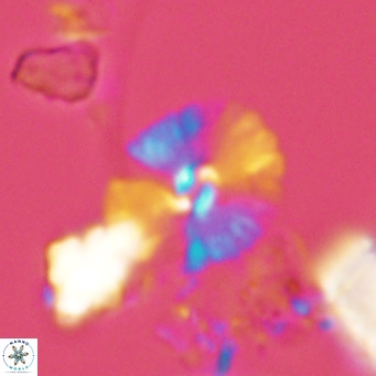 Umbellosphaera tenuis VR 04593