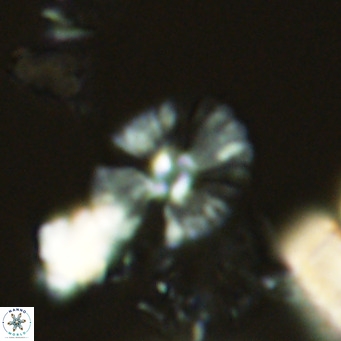 Umbellosphaera tenuis VR 04594