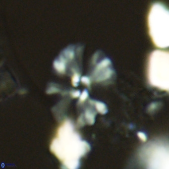 Umbellosphaera tenuis VR 04595