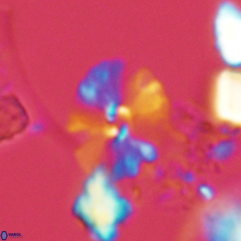 Umbellosphaera tenuis VR 04596