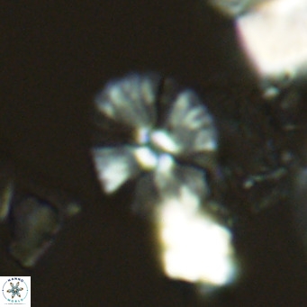 Umbellosphaera tenuis VR 04597