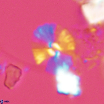 Umbellosphaera tenuis VR 04598