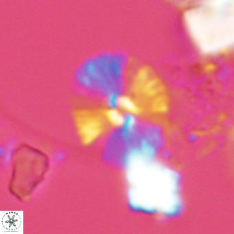 Umbellosphaera tenuis VR 04598