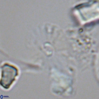 Umbellosphaera tenuis VR 04599