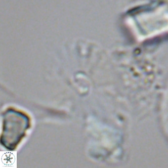 Umbellosphaera tenuis VR 04599