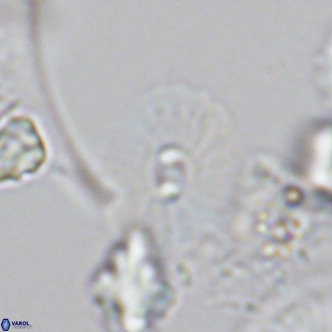 Umbellosphaera tenuis VR 04600