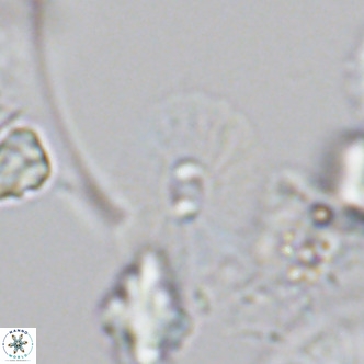 Umbellosphaera tenuis VR 04600