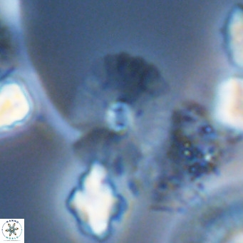 Umbellosphaera tenuis VR 04605