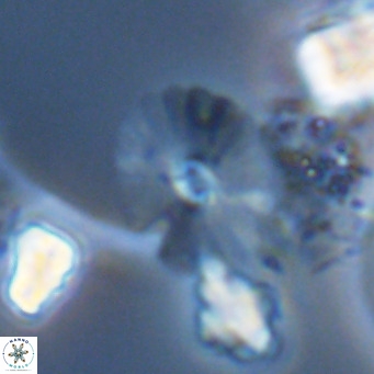 Umbellosphaera tenuis VR 04606