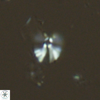 Umbellosphaera tenuis VR 04700