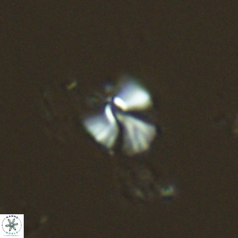 Umbellosphaera tenuis VR 04704