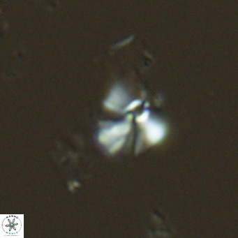 Umbellosphaera tenuis VR 04705