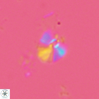 Umbellosphaera tenuis VR 04706
