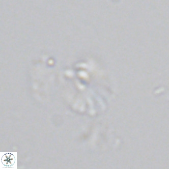 Umbellosphaera tenuis VR 04708