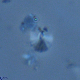 Umbellosphaera tenuis VR 04710