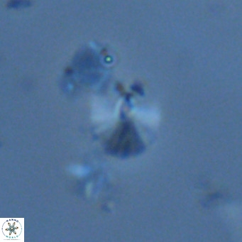 Umbellosphaera tenuis VR 04710