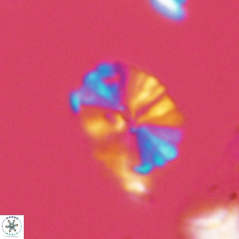 Umbellosphaera tenuis VR 04277
