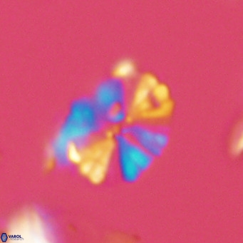 Umbellosphaera tenuis VR 04281