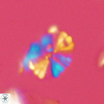 Umbellosphaera tenuis VR 04281