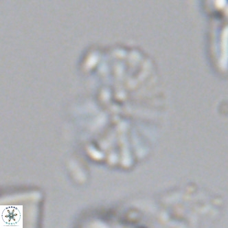 Umbellosphaera tenuis VR 04284