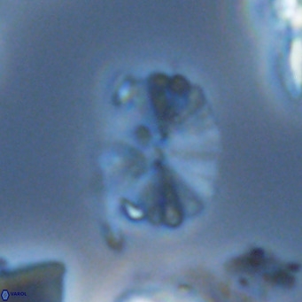 Umbellosphaera tenuis VR 04287