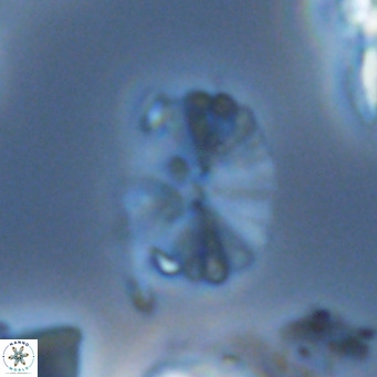 Umbellosphaera tenuis VR 04287