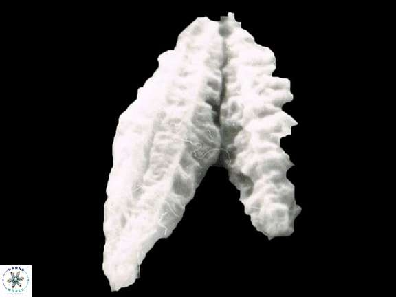 V emelinesalleyae 4