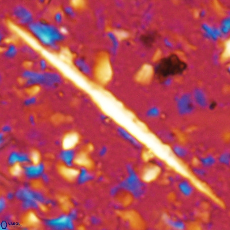 Velonalithus emelinesalleyae 27113