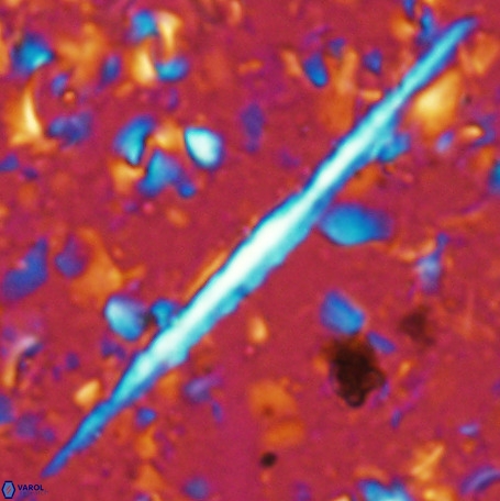 Velonalithus emelinesalleyae 27113