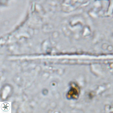 Velonalithus rioi VR 16592