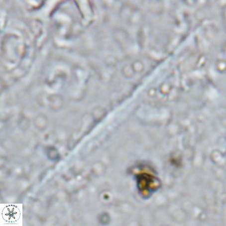 Velonalithus rioi VR 16593