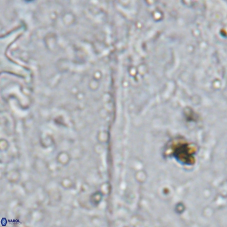 Velonalithus rioi VR 16595