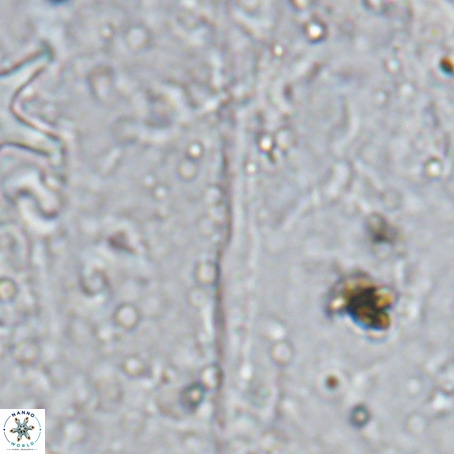 Velonalithus rioi VR 16595