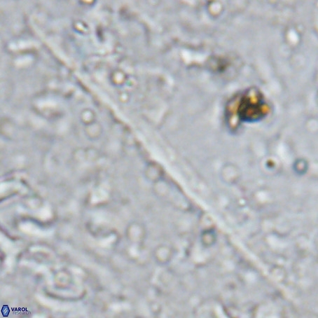 Velonalithus rioi VR 16597