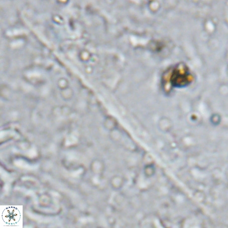 Velonalithus rioi VR 16597