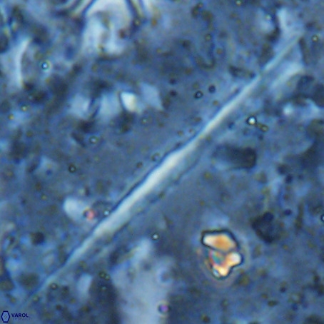 Velonalithus rioi VR 16601