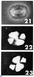 Watznaueria bayackii 11638